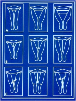 Uterus Shapes